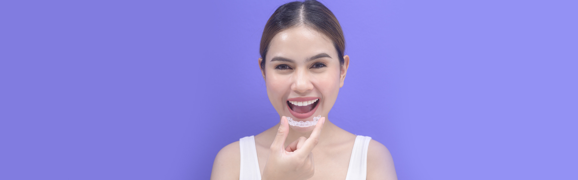 What Do I Need to Do to Prepare for Invisalign®?